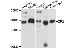 Western blot analysis of extracts of various cell lines, using ZP2 antibody. (ZP2 Antikörper)