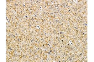 ABIN7095967 and ABIN7100029 at 1/100 staining rat brain tissue by IHC-P.