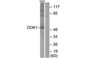 Western blot analysis of extracts from K562 cells, treated with Starvation 24h, using p62 Dok (Ab-398) Antibody.