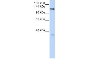 TMEM16C antibody used at 1 ug/ml to detect target protein. (ANO3 Antikörper  (C-Term))