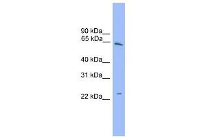 WB Suggested Anti-HSPB8  Antibody Titration: 0. (HSPB8 Antikörper  (Middle Region))