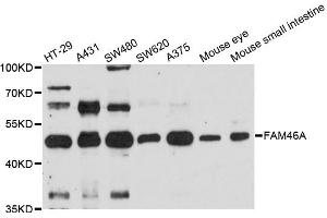 Western blot analysis of extracts of various cell lines, using FAM46A antibody. (FAM46A Antikörper)