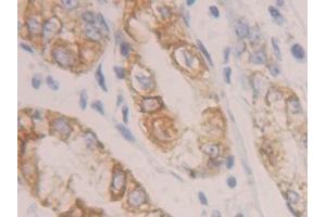 Detection of CK19 in Human Stomach Tissue using Polyclonal Antibody to Cytokeratin 19 (CK19) (Cytokeratin 19 Antikörper  (AA 245-391))