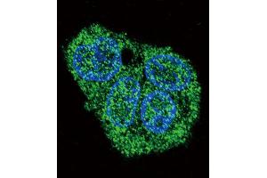 Immunofluorescence (IF) image for anti-Surfactant Protein C (SFTPC) antibody (ABIN2997467) (Surfactant Protein C Antikörper)
