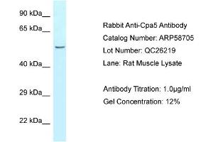 Western Blotting (WB) image for anti-Carboxypeptidase A5 (CPA5) (N-Term) antibody (ABIN2787796) (CPA5 Antikörper  (N-Term))