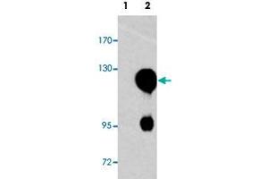 Western blot analysis of ROR2 (arrow) using ROR2 polyclonal antibody .