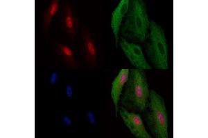 ABIN6260726 and ABIN6266946 staining  cells by IF/ICC. (CDKL4 Antikörper  (Internal Region))