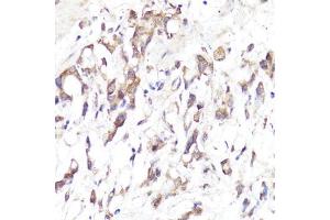 Immunohistochemistry (IHC) image for anti-Selectin L (SELL) (AA 1-100) antibody (ABIN3022264)