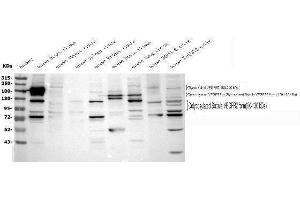 Western blot analysis of VEGF Receptor 2 using anti-VEGF Receptor 2 antibody (ABIN5693262). (VEGFR2/CD309 Antikörper  (AA 20-244))