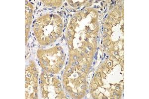 Immunohistochemistry of paraffin-embedded human kidney using RAB5C antibody. (Rab5c Antikörper  (AA 1-216))