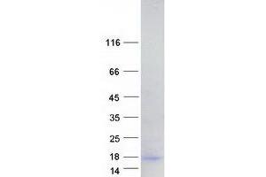 Western Blotting (WB) image for HOP Homeobox (HOPX) (Transcript Variant 3) protein (Myc-DYKDDDDK Tag) (ABIN2722945)