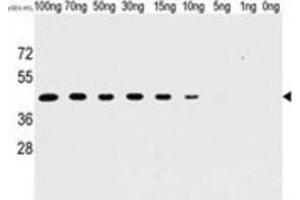 Western Blotting (WB) image for anti-Tyr/ser Protein Phosphatase antibody (ABIN2995280) (Tyr/ser Protein Phosphatase Antikörper)