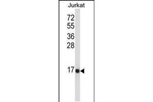 Western blot analysis in Jurkat cell line lysates (35ug/lane). (Tachykinin 3 Antikörper  (AA 54-83))