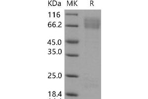 ADAM15 Protein (His tag)