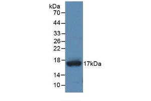 Western blot analysis of recombinant Human ADAMTS4. (ADAMTS4 Antikörper)