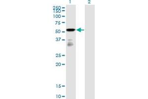 Western Blot analysis of FGFR1OP expression in transfected 293T cell line by FGFR1OP monoclonal antibody (M01), clone 2B1. (FGFR1OP Antikörper  (AA 1-379))