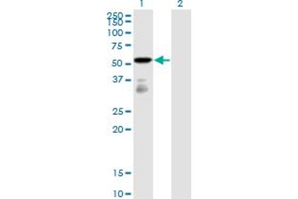 FGFR1OP Antikörper  (AA 1-379)
