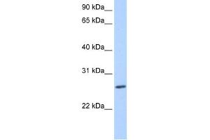 WB Suggested Anti-ZNF664 Antibody Titration:  0. (ZNF664 Antikörper  (N-Term))