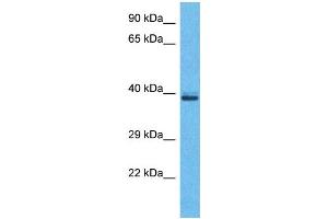 Western Blotting (WB) image for anti-Olfactory Receptor, Family 5, Subfamily H, Member 2 (OR5H2) (C-Term) antibody (ABIN2791755) (OR5H2 Antikörper  (C-Term))