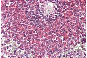 Immunohistochemistry (IHC) image for anti-Nuclear Factor of kappa Light Polypeptide Gene Enhancer in B-Cells 1 (NFKB1) (N-Term) antibody (ABIN1103248)
