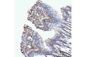 IHC analysis of GLUL using anti-GLUL antibody (ABIN7602403). (GLUL Antikörper  (AA 74-373))
