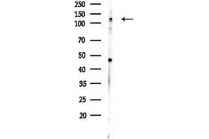 Western blot analysis of lysates from Mouse testis, using HDAC5 Antibody at 1/1000 dilution.