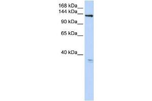 Human 293T; WB Suggested Anti-TMEM16C Antibody Titration: 0. (ANO3 Antikörper  (C-Term))