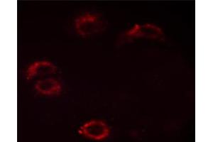 ABIN6267532 staining HUVEC cells by ICC/IF. (Crk Antikörper  (pTyr221))