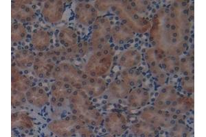 Immunohistochemistry (IHC) image for anti-Eosinophil Cationic Protein (ECP) (AA 34-150) antibody (ABIN7441832)
