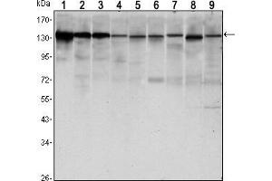 Western Blotting (WB) image for anti-Cadherin 1, Type 1, E-Cadherin (Epithelial) (CDH1) antibody (ABIN969036)