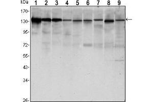 Western blot analysis using CDH1 mouse mAb against LNCAP (1),A431 (2), DU145 (3), PC-3 (4), MCF-7 (5), PC-12 (6), NIH/3T3 (7), C6 (8) and COS7 (9) cell lysate. (E-cadherin Antikörper)