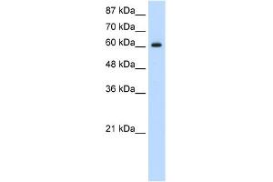 WB Suggested Anti-HIF3A Antibody Titration:  1. (HIF3A Antikörper  (C-Term))