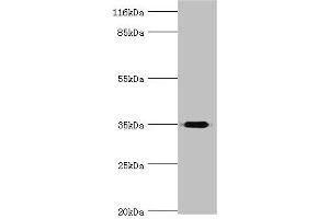 Western blot All lanes: DIMT1 antibody at 2 μg/mL + Mouse thymus tissue Secondary Goat polyclonal to rabbit IgG at 1/10000 dilution Predicted band size: 35 kDa Observed band size: 35 kDa (DIMT1 Antikörper  (AA 1-313))