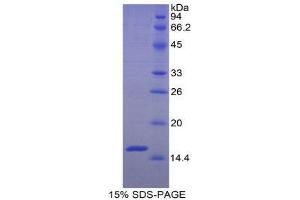 SDS-PAGE (SDS) image for Amiloride Binding Protein 1 (Amine Oxidase (Copper-Containing)) (ABP1) (AA 197-322) protein (His tag) (ABIN2120960) (DAO Protein (AA 197-322) (His tag))