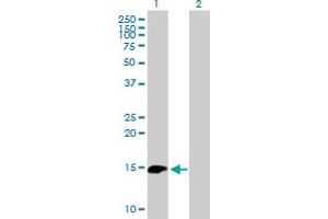 Western Blot analysis of BIRC5 expression in transfected 293T cell line by BIRC5 MaxPab polyclonal antibody. (Survivin Antikörper  (AA 1-142))
