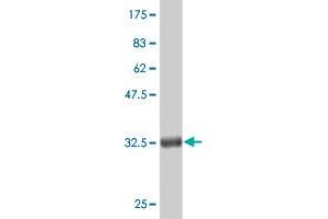 Western Blot detection against Immunogen (36. (CTNNB1 Antikörper  (AA 682-781))