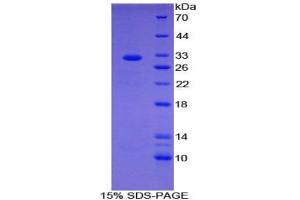 SDS-PAGE analysis of Human CIDEC Protein. (CIDEC Protein)