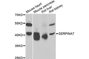 Western blot analysis of extracts of various cell lines, using SERPINA7 antibody (ABIN5975019) at 1/1000 dilution. (SERPINA7 Antikörper)