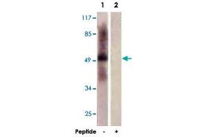 Western blot analysis of extracts from HepG2 cells, using TPH1 polyclonal antibody . (Tryptophan Hydroxylase 1 Antikörper  (AA 25-75))