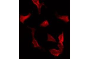 ABIN6275618 staining Hela by IF/ICC. (SYT16 Antikörper  (Internal Region))