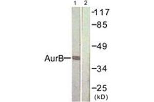 Western blot analysis of extracts from COS7 cells, treated with Nocodazole 1ug/ml 16h, using AurB (Ab-232) Antibody. (Aurora Kinase B Antikörper  (AA 198-247))