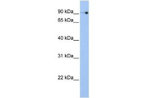 WB Suggested Anti-NOC3L Antibody Titration:  0. (NOC3L Antikörper  (N-Term))