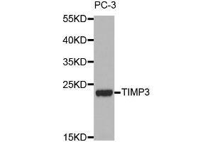 Western blot analysis of extracts of PC-3 cell lines, using TIMP3 antibody. (TIMP3 Antikörper  (AA 24-211))