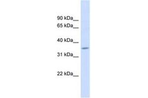 Image no. 1 for anti-Family with Sequence Similarity 26, Member F (FAM26F) (AA 143-192) antibody (ABIN6742019)
