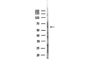 anti-AarF Domain Containing Kinase 2 (ADCK2) (Internal Region) antibody