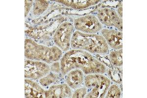 Immunohistochemistry (IHC) image for anti-Valosin Containing Protein (VCP) (AA 647-806) antibody (ABIN6150072)