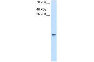 WB Suggested Anti-RBP1 Antibody Titration:  2. (RBP1 Antikörper  (Middle Region))