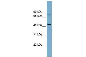 WB Suggested Anti-FZD6 Antibody Titration:  0.