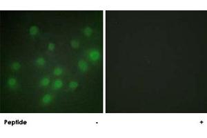 Immunofluorescence analysis of HUVEC cells, using HKR1 polyclonal antibody . (HKR1 Antikörper)