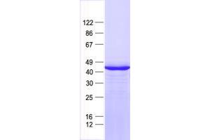 Validation with Western Blot (PITX2 Protein (His tag))